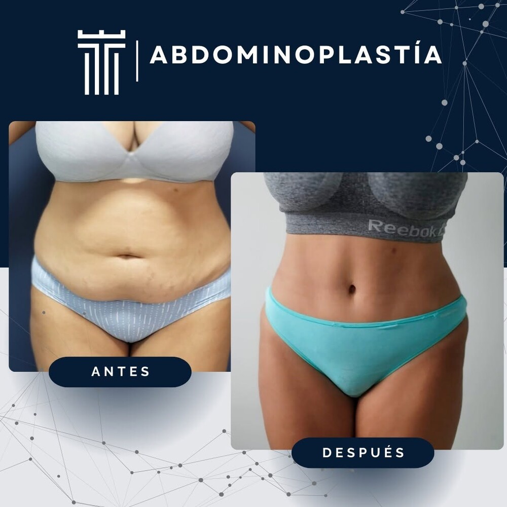 Clinic Results Gallery